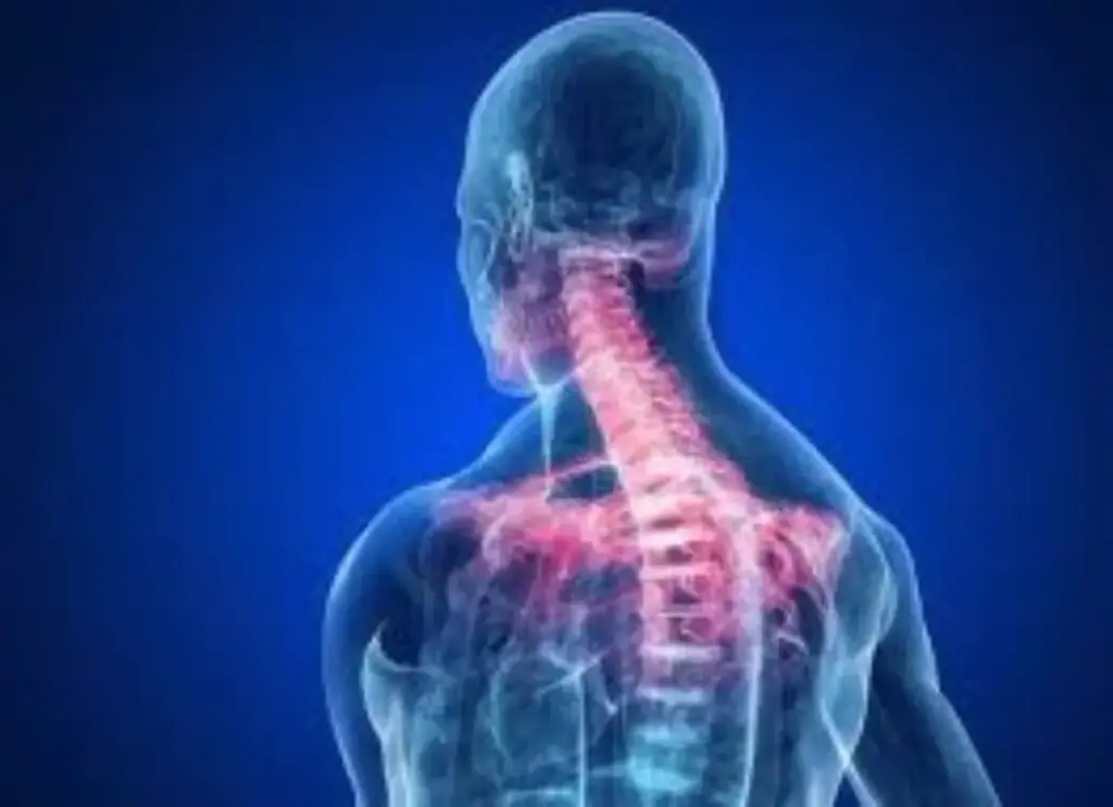 Ilustrasi beban pada tulang belakang saat menunduk menatap layar HP, risiko cedera leher, dan cara memperbaiki