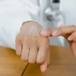 Tips skincare-an untuk penderita eksim