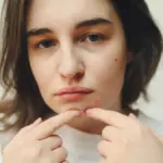 potret seorang perempuan memecahkan jerawat di dagu