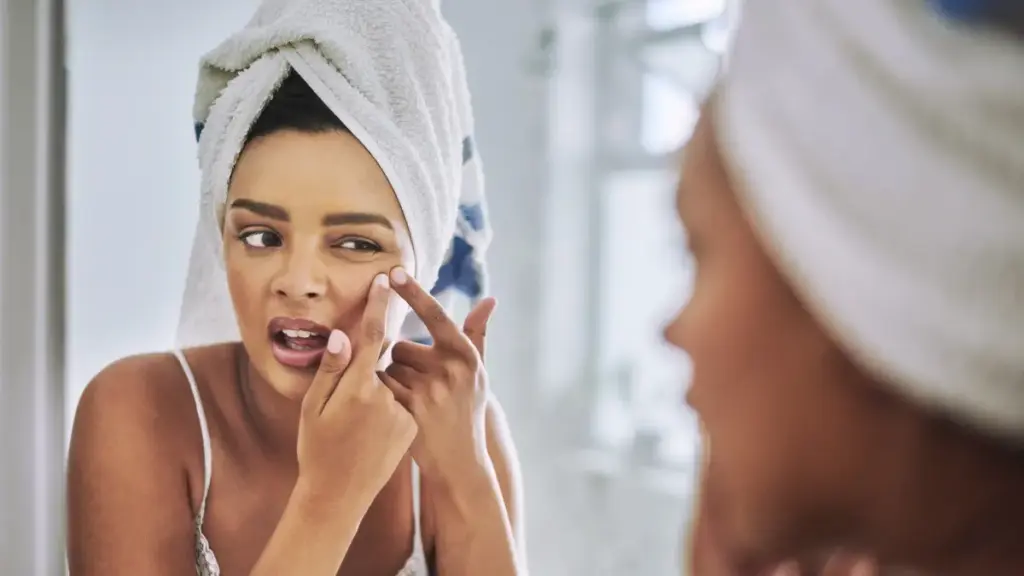 Tampil Maksimal Tanpa Jerawat di Hari Raya: Berikut Tips Cegah Breakout Sebelum Lebaran