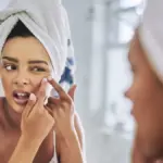 Tampil Maksimal Tanpa Jerawat di Hari Raya: Berikut Tips Cegah Breakout Sebelum Lebaran