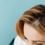Rambut Rontok Setelah Stres? Simak 5 Cara Menumbuhkan Rambut Kembali Secara Alami Ini